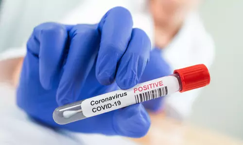 10373 ‍New Coronavirus cases Reported in Andhra Pradesh Today 05 06 2021