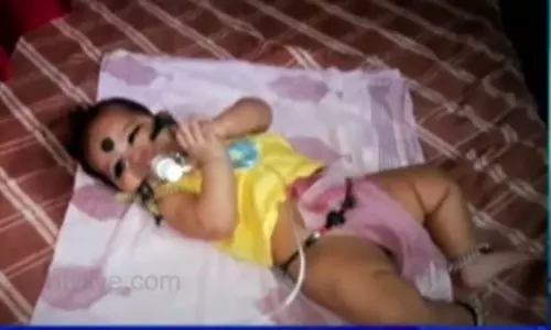 Chiranjeevi Charitable Trust Save a Childs Life