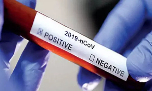 8110 ‍New Coronavirus Cases Reported in Andhra Pradesh Today 10 06 2021