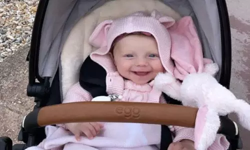 Five Months Old Baby Girl Turning into like Stone in England