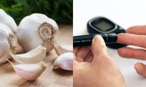 8 Incredible Garlic Health Benefits for Women and Men 8 Incredible Garlic Health Benefits for Women and Men