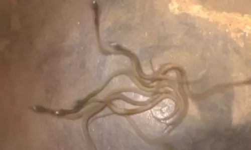 Cobra Snakes Highlight in Odisha Kalahandi Cobra Snakes Highlight in Odisha Kalahandi