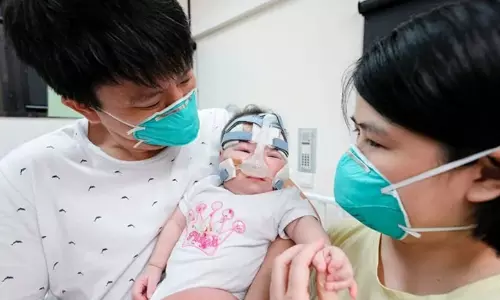 Singapore Doctors Gave Good Treatment to Low Weight Baby For 13 Months Singapore Doctors Gave Good Treatment to Low Weight Baby For 13 Months