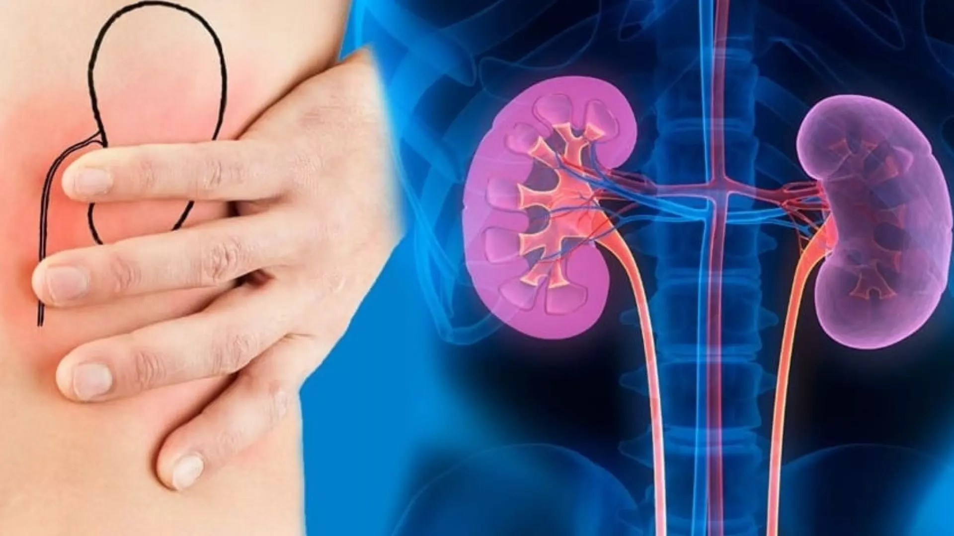 Seven Things that are Actually Damaging the Kidneys - hmtvlive.com