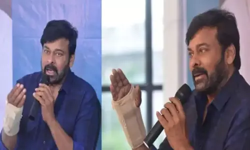 Surgery to Megastar Right Hand Surgery to Megastar Right Hand