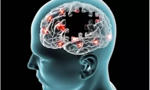 Learn About Alzheimers Symptoms and Treatment Learn About Alzheimers Symptoms and Treatment