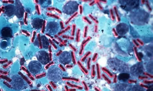 Four Sheeps and One Goat Killed with Anthrax Disease in Warangal Four Sheeps and One Goat Killed with Anthrax Disease in Warangal