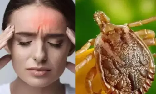 Scrub Typhus Virus in Telangana | Telangana Latest News Scrub Typhus Virus in Telangana | Telangana Latest News