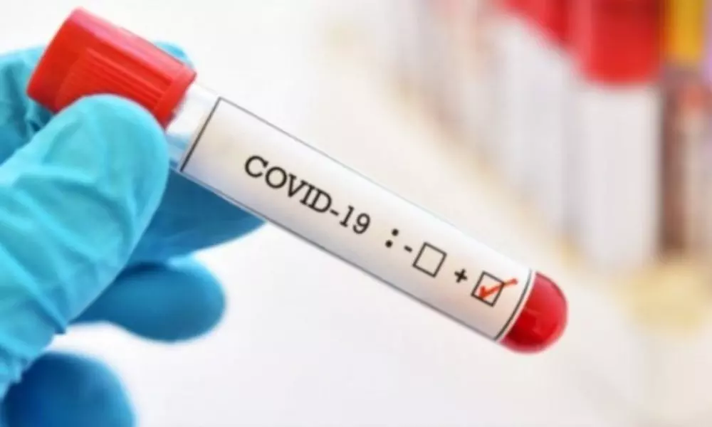 These Foods are Avoid When You Are in Tested Covid Positive Quarantine Period | Corona Live Updates