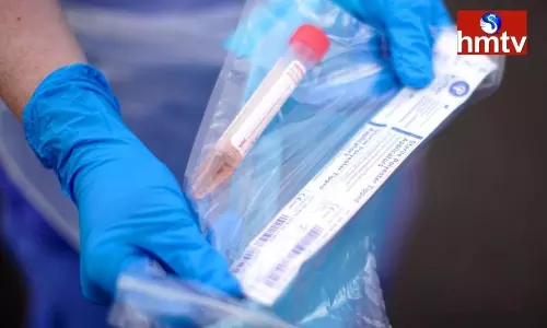 Covid Tests Stopped at Anantapur General Hospital