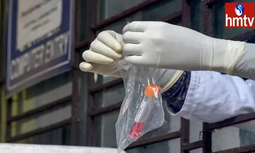 Newly Found NeoCov COVID Variant by Wuhan Scientists