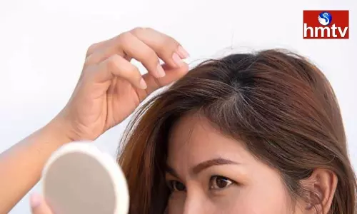 Malnutrition is the cause of white hair at an early age