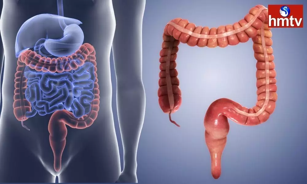 These 3 Habits Keep the Intestines Healthy and the Stomach Healthy Too