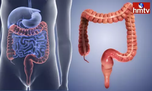 These 3 Habits Keep the Intestines Healthy and the Stomach Healthy Too These 3 Habits Keep the Intestines Healthy and the Stomach Healthy Too