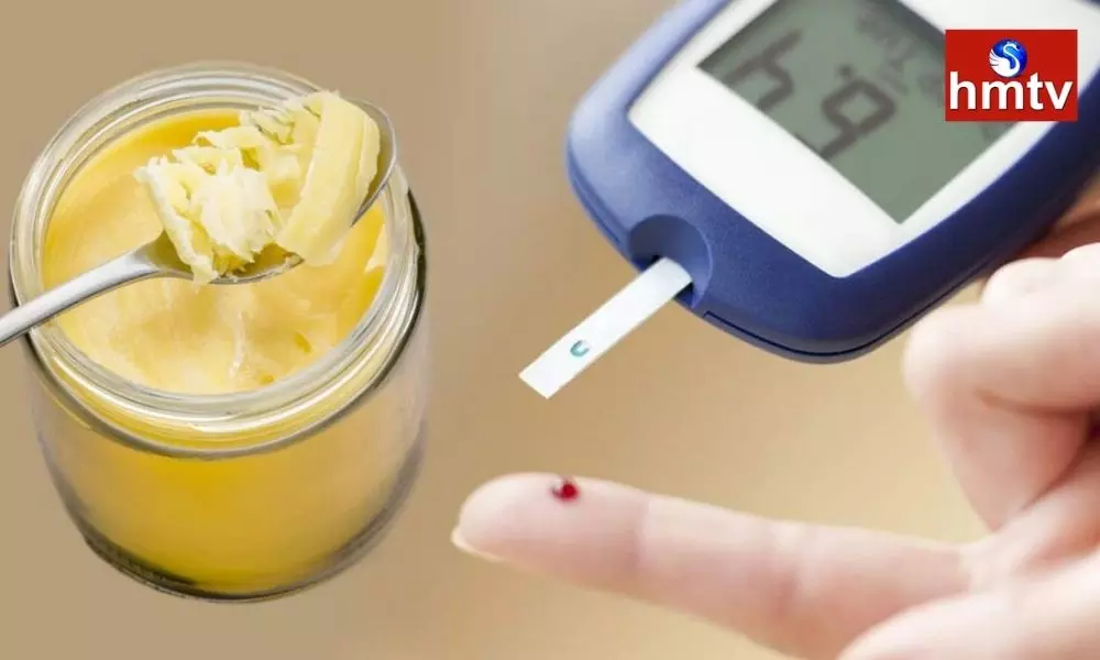 Health Tips Diabetic Patient Should Eat Desi Ghee or Not