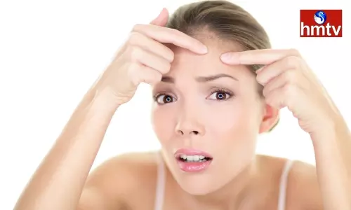 Troubled with Blackheads on The Face Try These Tips Troubled with Blackheads on The Face Try These Tips