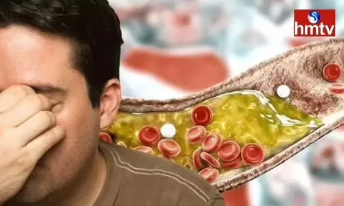 Risk of High Cholesterol if These Symptoms Appear Risk of High Cholesterol if These Symptoms Appear