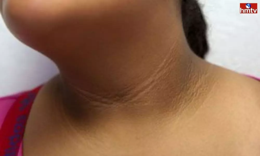 Follow These Tips if The Skin on the Neck in Black | Beauty Care Tips