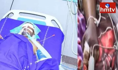 A Rat Nibble Victim Srinivas Passes Away