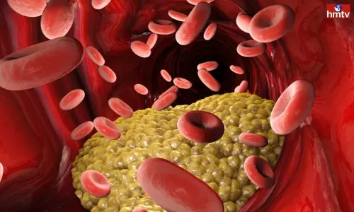 Increase Good Cholesterol in the body to Avoid these Diseases | Health Care Tips Increase Good Cholesterol in the body to Avoid these Diseases | Health Care Tips