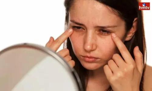 Check for Dark Circles With Pure Milk Check for Dark Circles With Pure Milk
