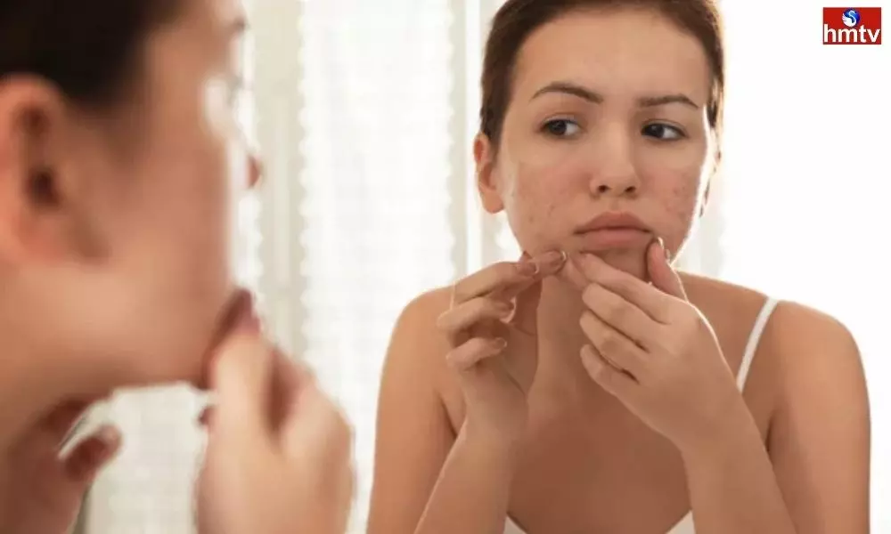 These Five Factors Can Cause Acne on the Face