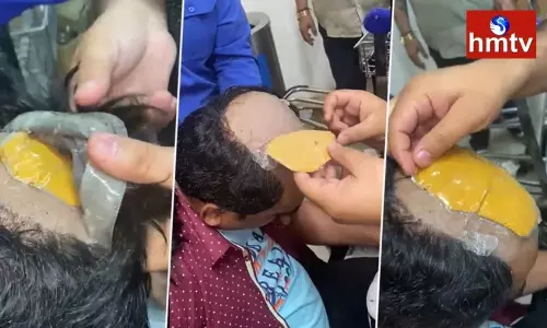 Man Smuggling Gold In His Wig