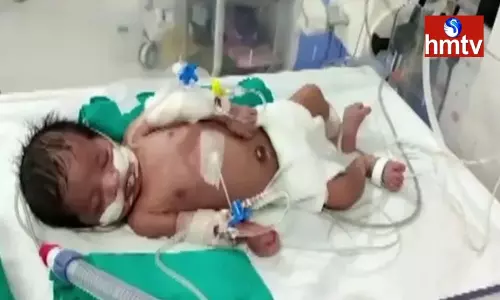 Mothers Touch Saves the Life of a Baby Mothers Touch Saves the Life of a Baby