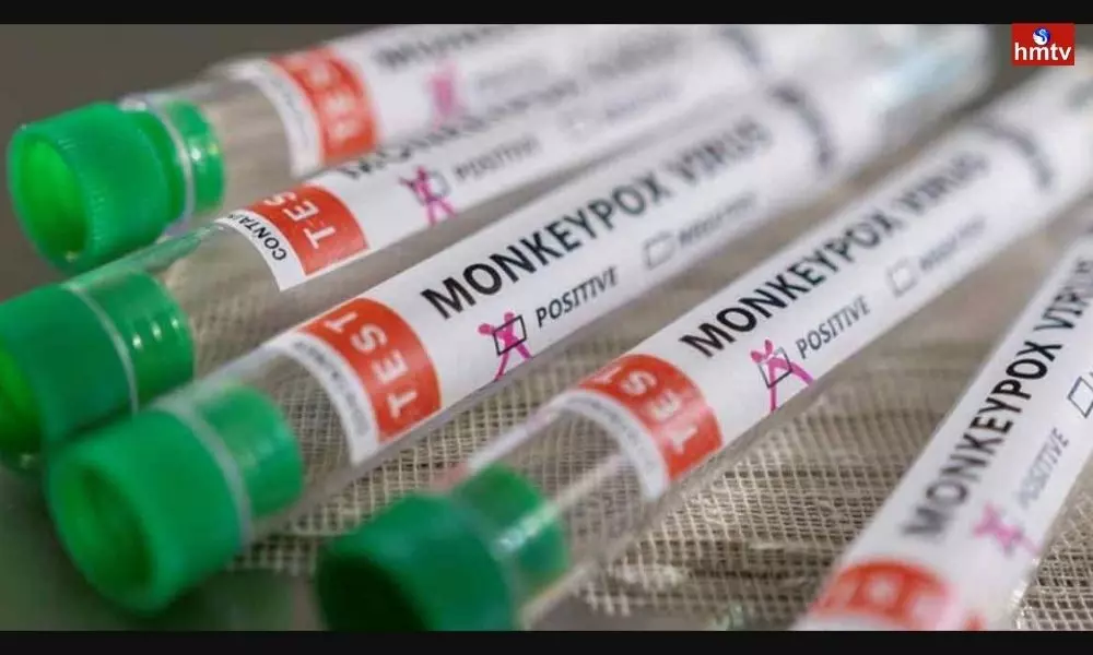 Monkeypox Virus Cases in World | Telugu News