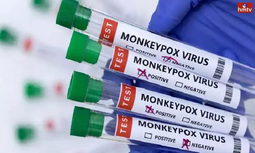 200 Cases of Monkeypox in World | World News