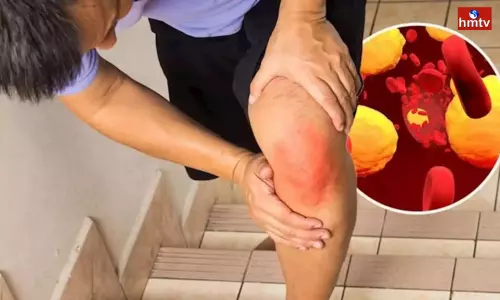 is There Severe Pain in These 3 Parts of the Body Understand that Cholesterol Levels Have Risen