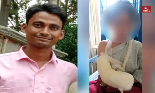 Husband Cut Off Wife Hand in West Bengal Husband Cut Off Wife Hand in West Bengal