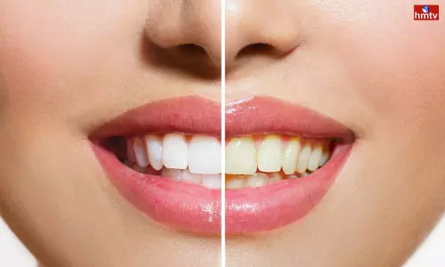 Teeth turn yellowish green try these 3 items in the kitchen