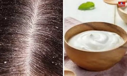 Check for Dandruff Problem With Lemon and Yogurt Check for Dandruff Problem With Lemon and Yogurt