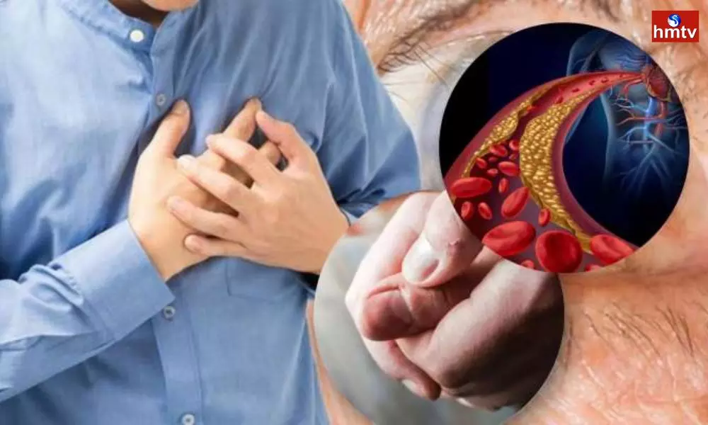 These are the Main Reasons for the Increase in Bad Cholesterol in the Body
