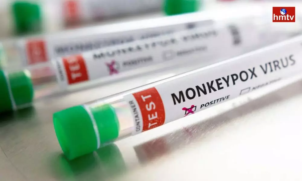 Monkeypox Case Reported in Kerala | MonkeyPox News