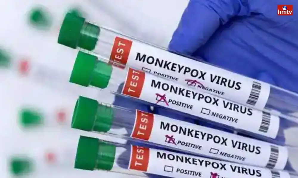 Monkeypox Case Live Updates | Telugu News