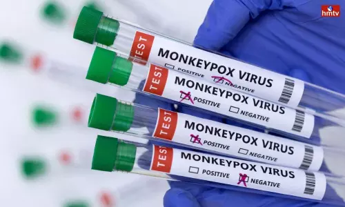 Monkeypox Test Kits for Hyderabad Gandhi Hospital