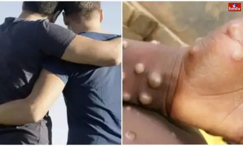 WHO Recommends gay and Bisexual Men Limit Sexual Partners to Reduce the Spread of Monkeypox WHO Recommends gay and Bisexual Men Limit Sexual Partners to Reduce the Spread of Monkeypox