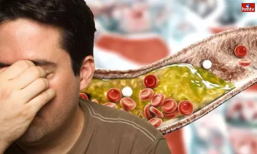 High Cholesterol is Life Threatening Stop These Old Habits Today High Cholesterol is Life Threatening Stop These Old Habits Today