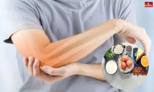 Have Weak Bones at a Young Age Include These Foods in Your Daily Diet