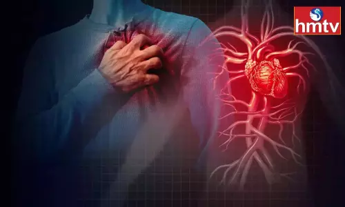 Note the Difference Between Cardiac Arrest and Heart Attack Otherwise it is Very Dangerous