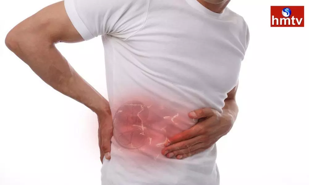Avoid these foods during kidney stone