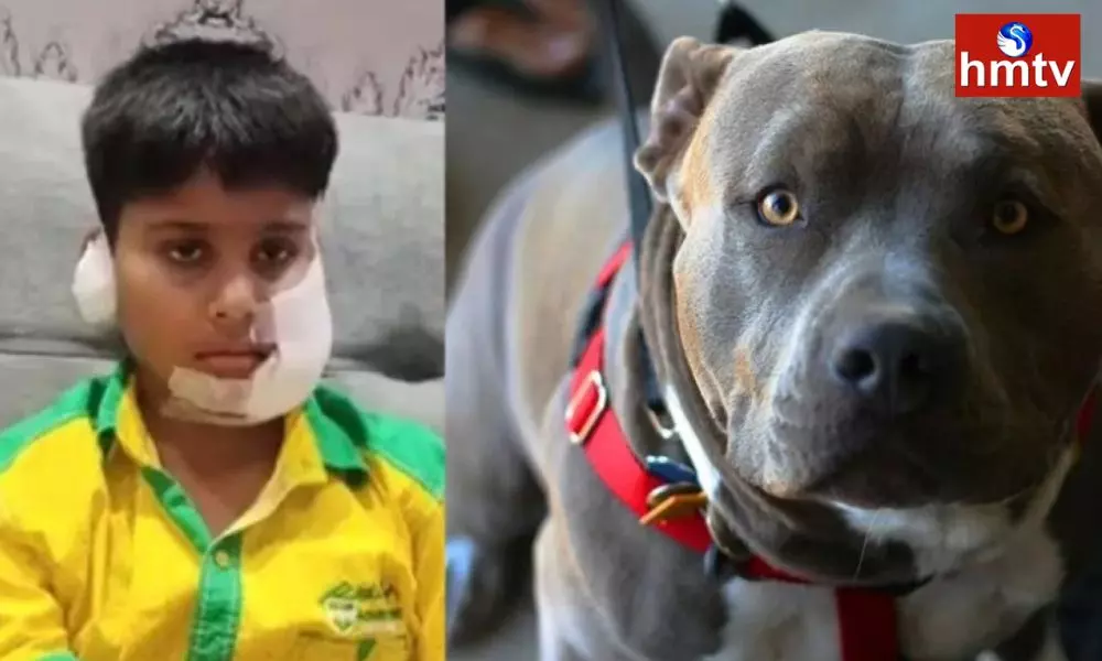 A Dog Attacked a Child in Ghaziabad