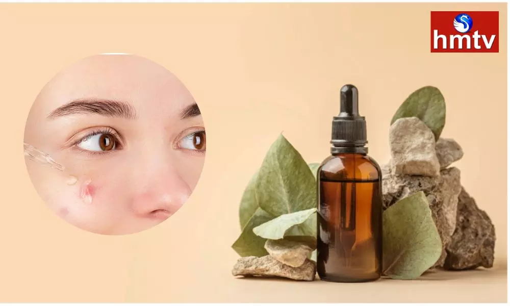 Tea Tree Oil is Best for Skin Care Blackheads and Pimples Disappear Immediately After Using it