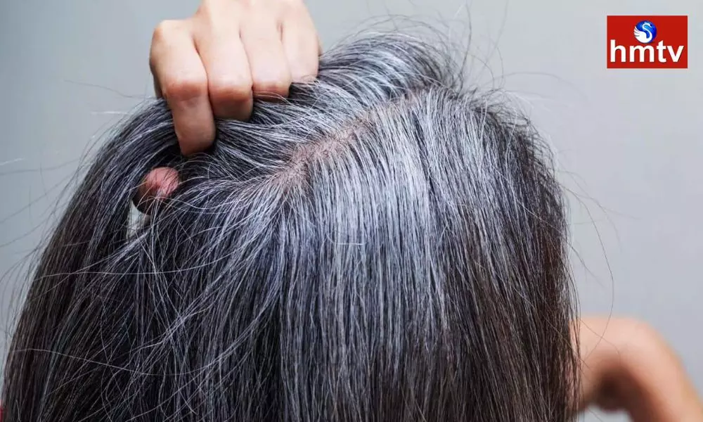 White Hair: మొదటిసారి తెల్లవెంట్రుకలు కనిపించాయా.. వెంటనే ఇలా ఆపండి..! |  Try these tips to stop white hairs from appearing for the first time