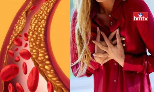 After the Age of 20 the Risk of Bad Cholesterol Increases These Should be Removed From the Diet Immediately