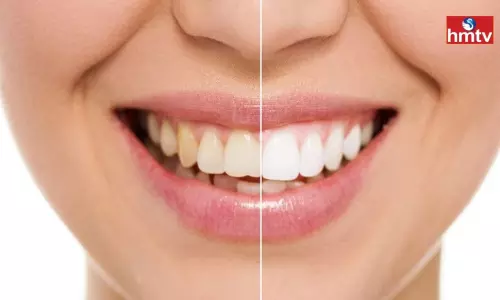 Have Your Teeth Turned Yellow Follow These Tips Have Your Teeth Turned Yellow Follow These Tips