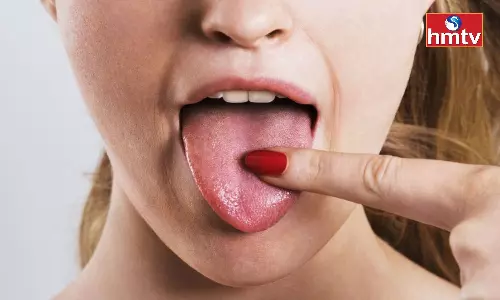 Do you Often Have Dry Mouth Follow These Tips