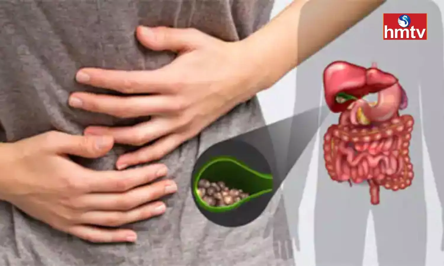 If you Have Gall Bladder Stones you Should Avoid These Substances